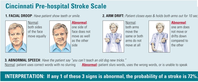 stroke-scale